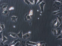 HeLa-Zellen mit Hefe-Kontamination